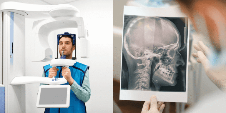 3D CBCT Scan in Tijuana