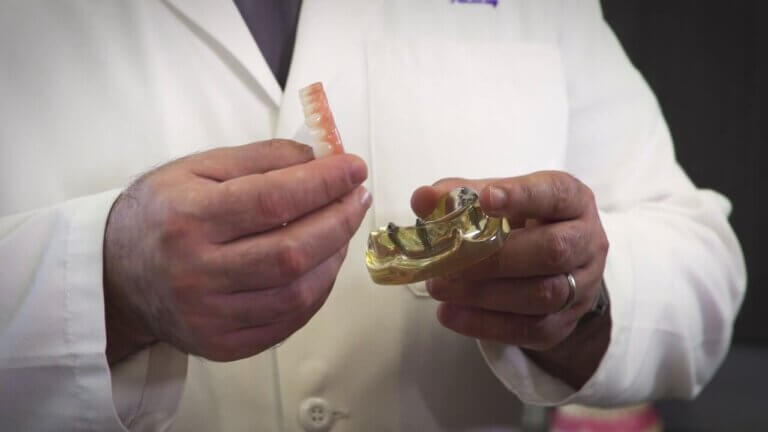 All-on-4 dental implants in Tijuana